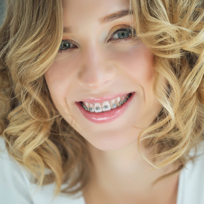 Blue Ridge Dental | Digital Impressions, Sports Mouthguards and Teeth Whitening