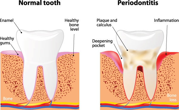 Blue Ridge Dental | CBCT, Digital Impressions and Digital Radiography