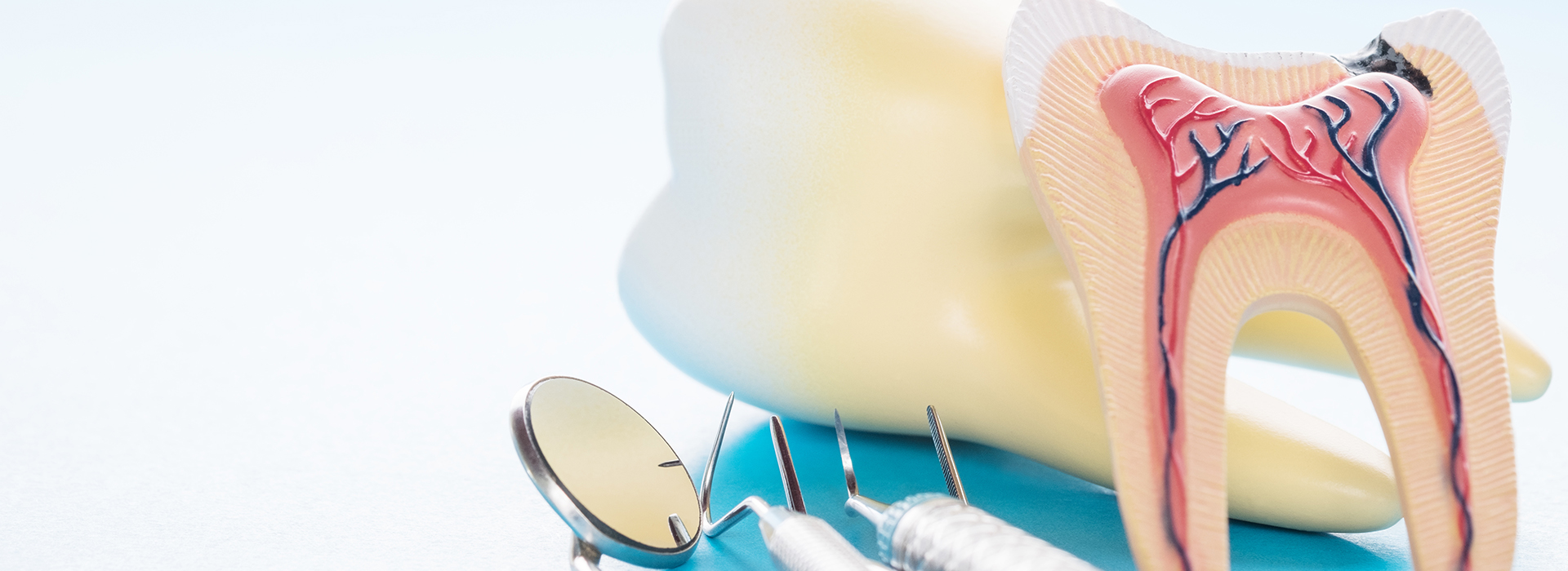 Blue Ridge Dental | Fluoride Treatment, Oral Exams and Digital Impressions